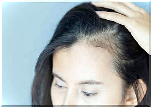 Alopecia in women - The psychological consequences