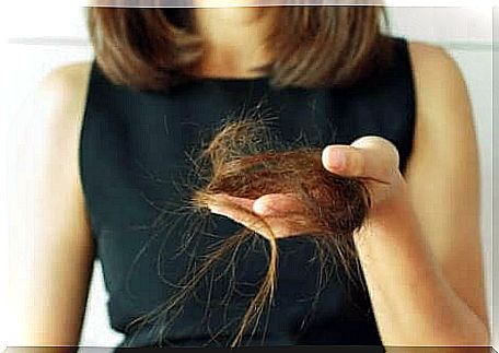 There are several types of alopecia in women.