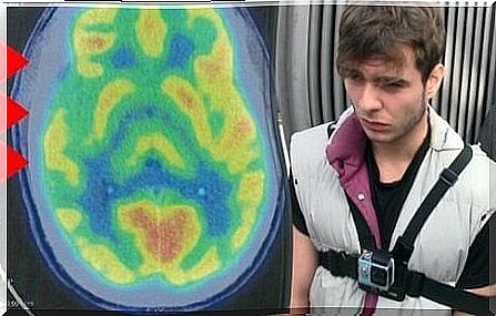 A brain scan by a psychopath