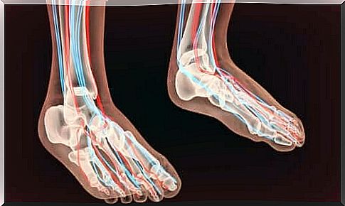 Polyneuropathy